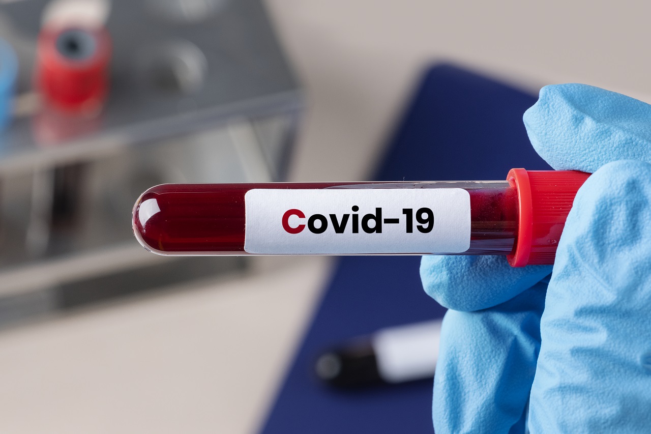cirurgião a segurar um tubo de ensaio de sangue com o rótulo covid-19